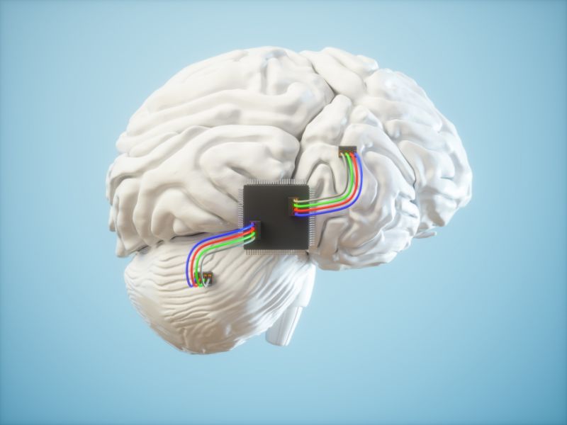 Elon Musk a montré Neuralink v2, la puce avec interface cerveau-ordinateur