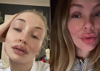 Plastic surgery filter TikTok: How to get and use it?