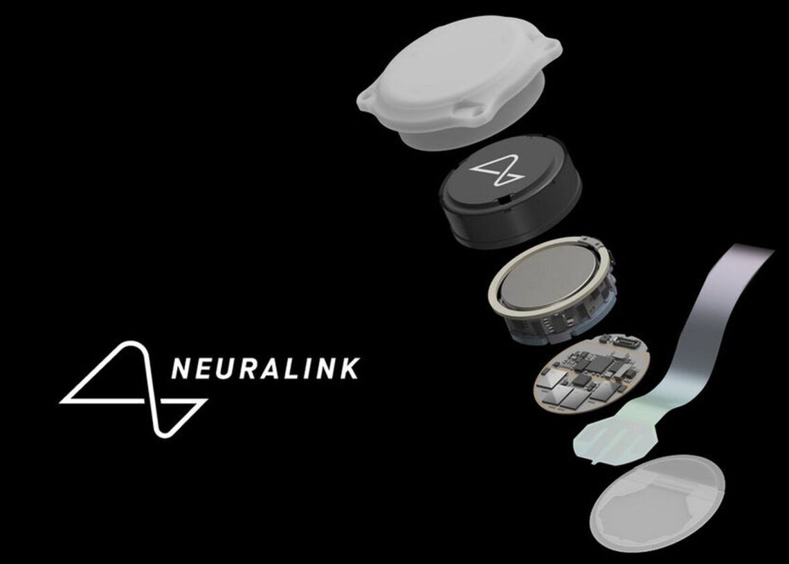 Elon Musk brain implant project Neuralink volunteer