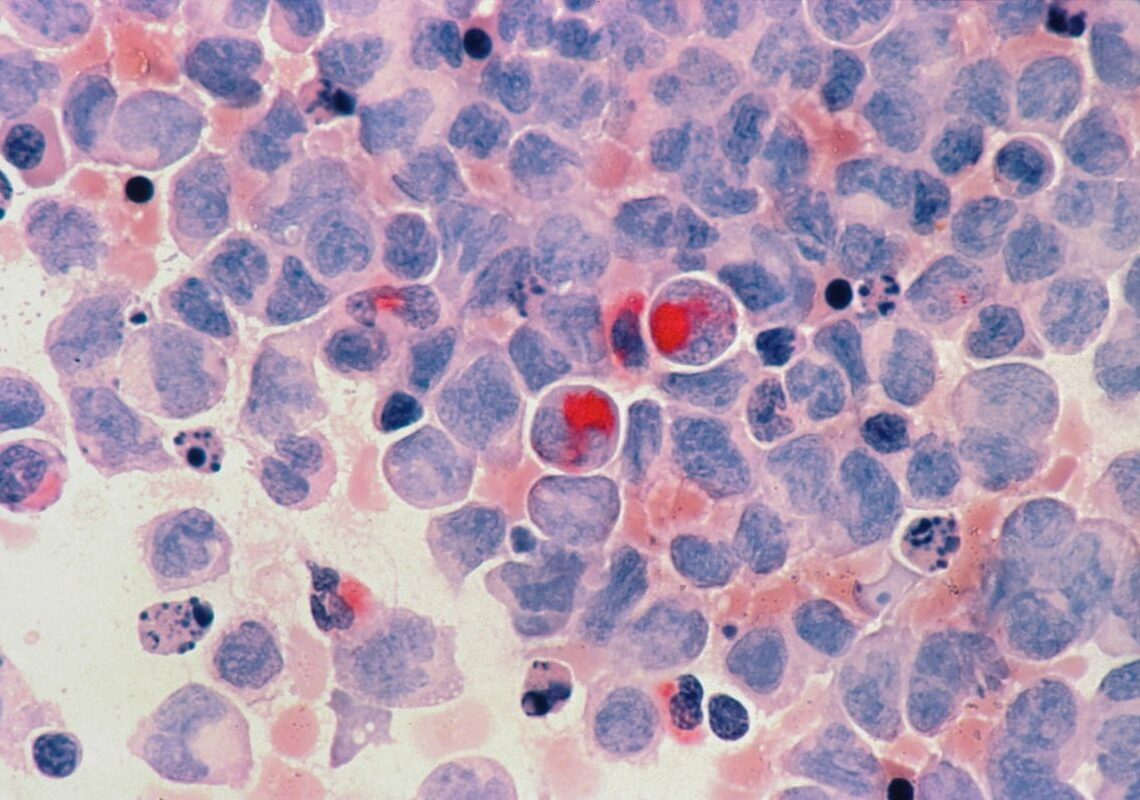 Jacobio grants AstraZeneca rights to JAB-23E73 for $2B