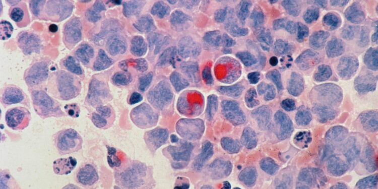 New  billion AstraZeneca deal targets 23% of all cancer types